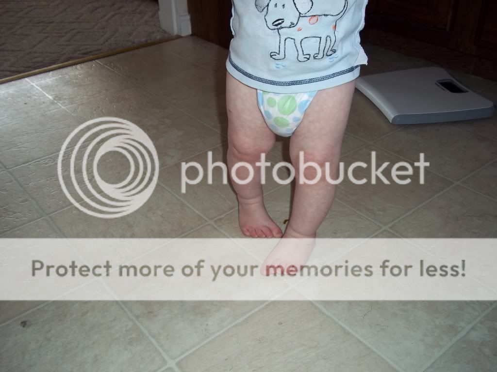 Bowlegged 17 month old. Starting to worry! BabyGaga